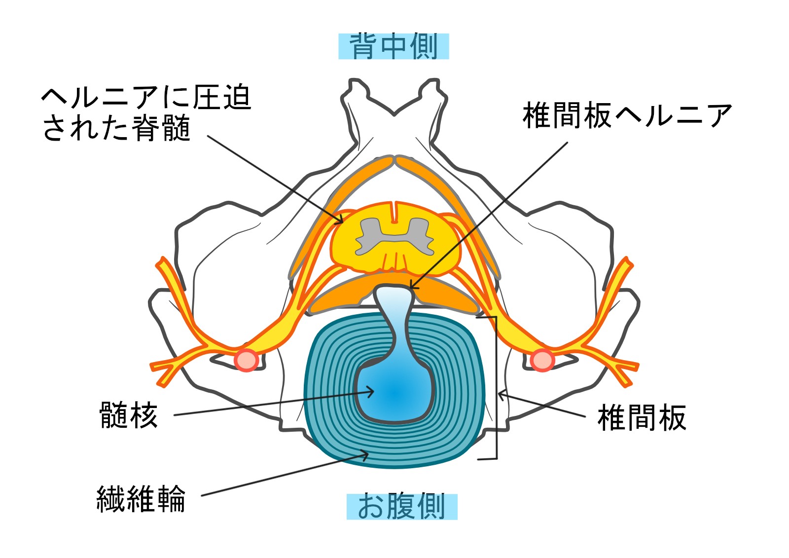 椎間板ヘルニア | ぞのペットクリニック | さいたま市緑区の動物病院